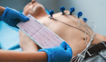 Electrocardiography