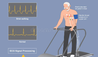Exercise-Treadmill