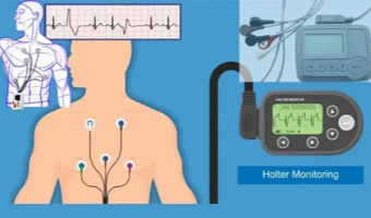 Holter-Event-Monitoring